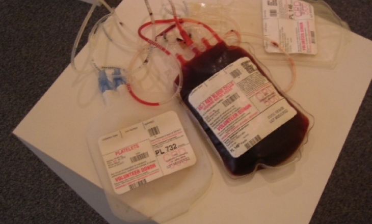 HIV infected